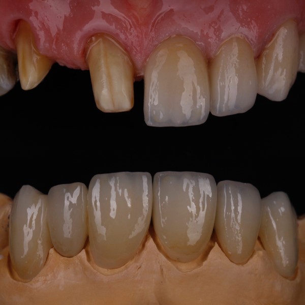 images/smile-gallery/B5F47394-11C2-48F5-BC19-0998F512E292.jpg
